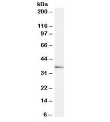 Western blot testing of human testis lysate with TACR1 antibody at 1ug/ml. Predicted molecular weight ~46kDa but routinely observed at ~58kDa. Image shows detection of the 'short' isoform at ~36kDa.