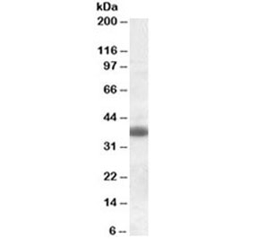 Western blot testing of rat brain lysate with Clu antibody at 0.3ug/ml. Predicted molecular weight: 75-80 kDa (heterodimer precursor), 36-39 kDa (alpha subunit), 34-36 kDa (beta subunit).