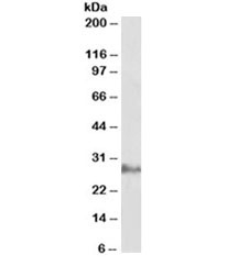 Western blot testing of human adipose lysate with IL22 antibody at 0.3ug/ml. Observed molecular weight: 19~25kDa depending on glycosylation level. 