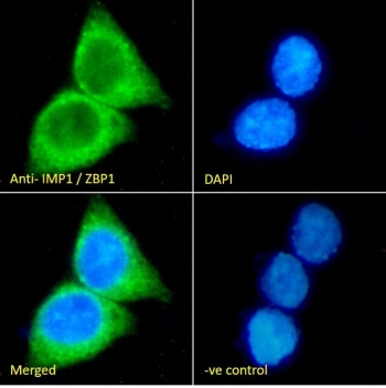 IF/ICC staining of fixed and permeabilized human HepG2 cells with ZBP-1 antibody (green) at 10ug/ml and DAPI nuclear stain (blue).
