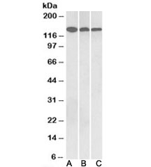 Western blot testing of human cerebellum [A], mouse brain [B] and rat brain [C] lysates with Contactin 1 antibody at 0.3ug/ml. Predicted molecular weight: ~113/135-150kDa (unmodified/glycosylated).