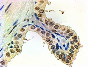 IHC staining of FFPE human prostate with Androgen receptor antibody at 2ug/ml. HIER: steamed with pH6 citrate buffer, AP-staining.