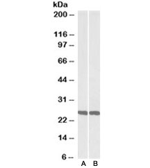 Western blot testing of mouse [A] and rat [B] brain lysate with UCHL1 antibody at 0.01ug/ml. Predicted molecular weight ~25 kDa.
