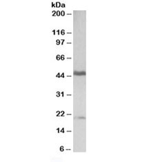 Western blot testing of human tonsil lysate with GATA3 antibody at 0.3ug/ml. Predicted molecular weight ~50 kDa. Both bands are blocked by the immunizing peptide.