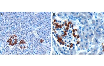 IHC testing of FFPE human pancreas with CCKAR antibody at 10ug/ml. HIER: microwaved with pH6 citrate buffer, HRP-staining.