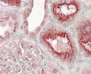 IHC testing of FFPE human kidney with VSP11 antibody at 4ug/ml. HIER: steamed with pH6 citrate buffer, AP-staining.