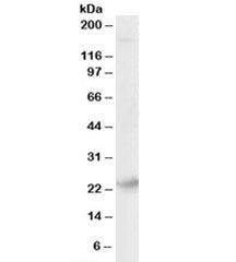 Western blot testing of human brain lysate with Synaptogyrin 4 antibody at 0.01ug/ml. Predicted molecular weight: ~26kDa.