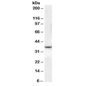 Western blot testing of human liver lysate with DARC antibody at 0.1ug/ml. Predicted molecular weight: ~36 kDa.