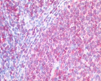 IHC staining of FFPE human tonsil tissue with CD74 antibody at 5ug/ml. Required HIER: steamed antigen retrieval with pH6 citrate buffer; AP-staining.