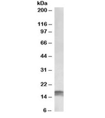 Western blot testing of HeLa lysate with CDKN2A antibody at 1ug/ml. Predicted molecular ~12kDa, observed here at ~17kDa.