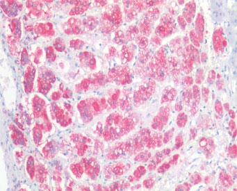 IHC testing of FFPE human adrenal gland tissue with NCAM antibody at 5ug/ml. Required HIER: steamed antigen retrieval with pH6 citrate buffer; AP-staining.