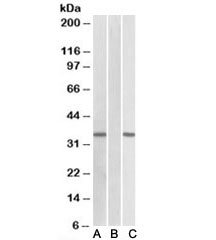 Western blot of HEK293 transfected with human CRISP2-MYC tested with CRISP2 antibody (0.1ug/ml) in Lane A and anti-MYC (1/1000) in lane C. Mock-transfected HEK293 probed with CRISP2 (1ug/ml) in Lane B. Predicted molecular weight: ~27/31kDa (isoforms 1/2).