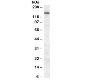 Western blot testing of human frontal cortex lysate with ABCC5 antibody at 0.5ug/ml. Predicted molecular weight: isoforms may be observed at ~23 kDa and 155-160 kDa.