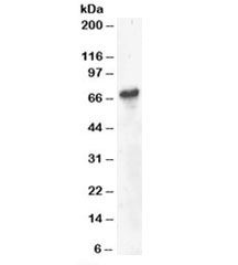 Western blot testing of Daudi lysate with BLNK antibody at 4ug/ml. Predicted molecular weight: ~51kDa but can be observed at 65-70kDa.