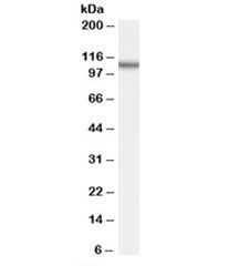 Western blot testing of human spleen lysate with OSBPL5 antibody at 2ug/ml. Predicted molecular weight: ~98 kDa, observed here at ~110 kDa.