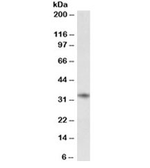 Western blot testing of human tonsil lysate with CD74 antibody. Expected molecular weight: 33-43 kDa.
