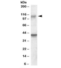 Western blot testing of rat brain lysate with GRIK3 antibody at 0.3ug/ml. The expected ~110kDa band and additional ~39kDa band are both blocked by the immunizing peptide.