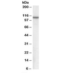 Western blot testing of human brain cerebral cortex lysate with NPEPPS antibody at 0.3ug/ml. Predicted molecular weight: ~100kDa.