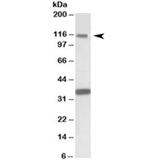 Western blot testing of human hippocampus lysate with KIT antibody at 1ug/ml. Observed molecular weight: ~120/145kDa (precusor/mature).