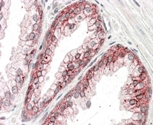 IHC staining of FFPE human prostate with alpha Catenin antibody at 3.8ug/ml. HIER: steamed with pH6 citrate buffer, AP-staining.