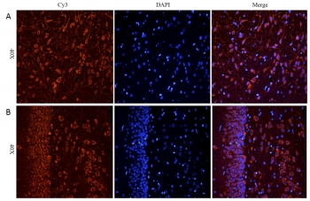 IHC staining of FFPE rat cerebral cortex [A] and rat hippocampus [B] with CHRNA antibody at 5ug/ml; DAPI nuclear counter stain (blue); HIER: pH6 citrate buffer at 95-98oC.