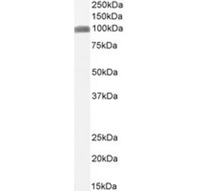 Western blot testing of human ThP-1 cell lysate with CSF1R antibody.