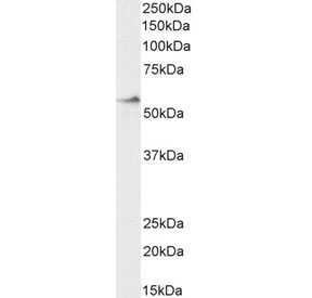 Western blot testing of human duodenum lysate with CRF1 antibody at 2ug/ml. Predicted molecular weight: ~48/60-70 kDa (unmodified/glycosylated).