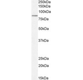 Western blot testing of human placental tissue lysate with TG2 antibody. Predicted molecular weight: ~78 kDa.