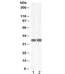 Western blot testing of 1) mouse liver and 2) rat liver lysate with Arginase antibody at 0.05ug/ml. Predicted molecular weight ~35 kDa.
