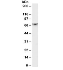 Western blot testing of rat brain lysate with PAK1 antibody at 1ug/ml. Expected molecular weight 60~70 kDa.