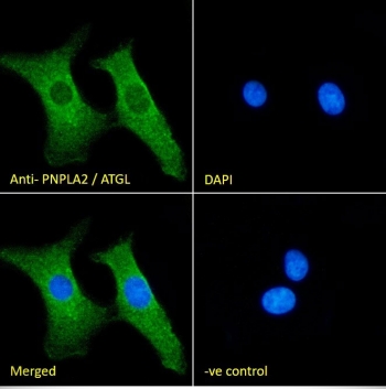 IF/ICC staining of fixed and permeabilized human HEK293 cells with Adipose triglyceride lipase antibody (green) at 10ug/ml and DAPI nuclear stain (blue).