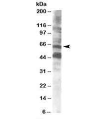 Western blot testing of human brain lysate  with CPEB antibody at 0.5ug/ml. Both the expected ~65kDa band and the additional ~48kDa band are blocked by the immunizing peptide.