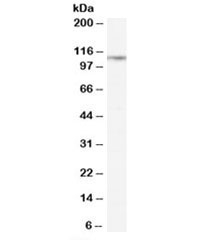Western blot testing of rat lung lysate with CD26 antibody at 0.3ug/ml. Predicted molecular weight: ~88 kDa (unmodified), ~110 kDa (glycosylated).
