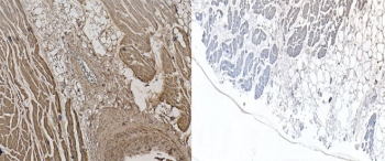 IHC testing of FFPE human heart tissue with NKX2.5 antibody (left) and without NKX2.5 antibody (right). Required HIER: steamed antigen retrieval with pH6 citrate buffer; AP-staining.