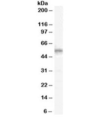 Western blot testing of human spleen lysate with WT1 antibody at 1ug/ml. Predicted molecular weight ~54 kDa.