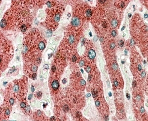 IHC testing of FFPE human liver with HRASLS2 antibody at 5ug/ml. HIER: microwaved with pH9 Tris/EDTA buffer, HRP-staining.