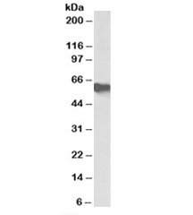 Western blot testing of human albunin-depleted serum with AHSG antibody at 0.5ug/ml. Predicted molecular weight: ~39/45-59kDa (unmodified/glycosylated).