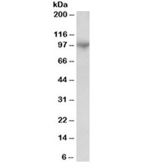 Western blot testing of human bone marrow lysate with ADAM8 antibody at 1ug/ml. Predicted molecular weight: ~89/79kDa (isoforms 1/3).