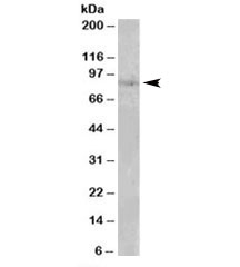 Western blot testing of human heart lysate with SETDB2 antibody at 0.1ug/ml. Predicted molecular weight: ~82kDa.