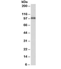 Western blot of human heart lysate with ADAM12 antibody at 0.1ug/ml. Predicted molecular weight: ~99/80kDa (long/short form), but observed at ~90/68kDa.