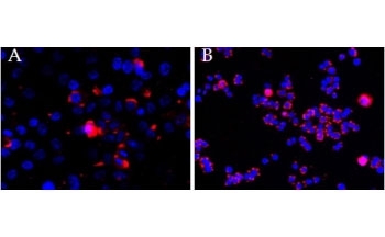 CEP290 antibody (2.5ug/ml) overnight staining of cell lines OPCT-1 [A] and MDA468 [B] with Alexa Fluor 568 [red] and nuclear counter staining with DAPI [blue].