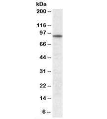 Western blot testing of human skeletal muscle lysate with UNC45B antibody at 0.3ug/ml. Predicted molecular weight: ~104/95kDa (isoforms 1/2).
