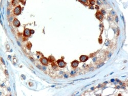 IHC testing of FFPE human testis with ALMS1 antibody at 2ug/ml. Microwaved antigen retrieval with Tris/EDTA buffer pH9, HRP-staining.