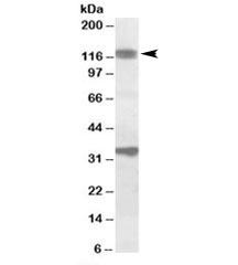 Western blot testing of rat skeletal muscle lysate with CCAR1 antibody at 1ug/ml. Predicted molecular weight: ~130kDa. Both observed bands are blocked by addition of immunizing peptide.