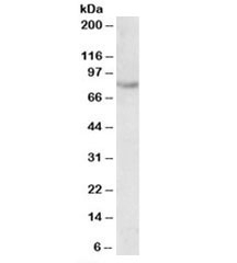 Western blot testing of fetal mouse kidney lysate with SIM2 antibody at 0.5ug/ml. Predicted molecular weight: 73kDa.