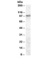 Western blot testing of rat brain lysate with Trpv2 antibody at 2ug/ml. Expected molecular weight: 85-95 kDa depending on glycosylation level.