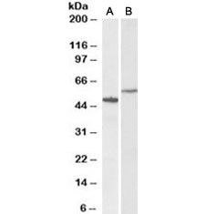 Western blot testing of human hippocampus [A] and HeLa [B] lysates with CD47 antibody at 0.3ug/ml. Predicted molecular weight: 35~60 kDa depending on glycosylation level.