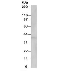 Western blot testing of human kidney lysate with VSP26A antibody at 1ug/ml. Predicted molecular weight: ~38kDa.