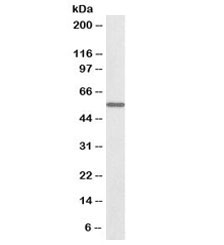 Western blot testing of mouse kidney lysate with biotinylated ALDH6A1 antibody at 0.1ug/ml. Predicted molecular weight: ~58 kDa.