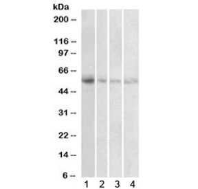 Western blot testing of human 1) placenta, 2) uterus, 3) adrenal gland and 4) pancreas lysate with VMAT2 antibody at 1ug/ml. Predicted molecular weight: ~55 kDa.